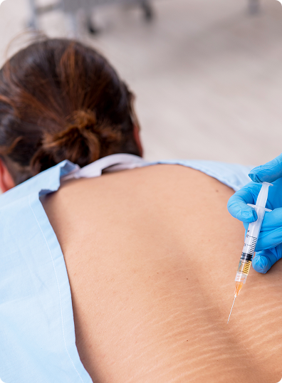 Epidural steroid injections